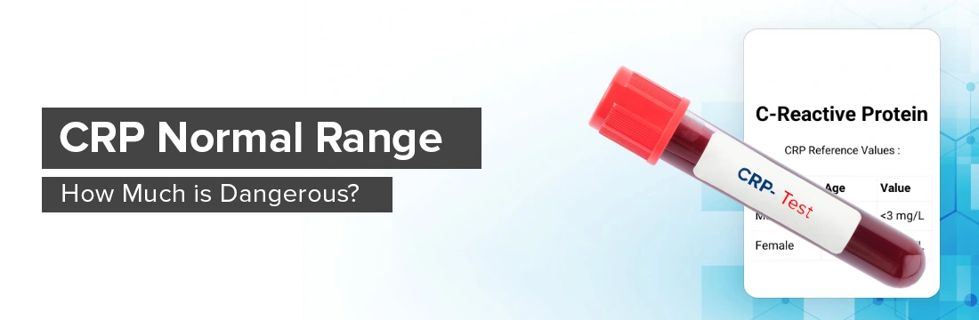 CRP Normal Range: How Much is Dangerous?